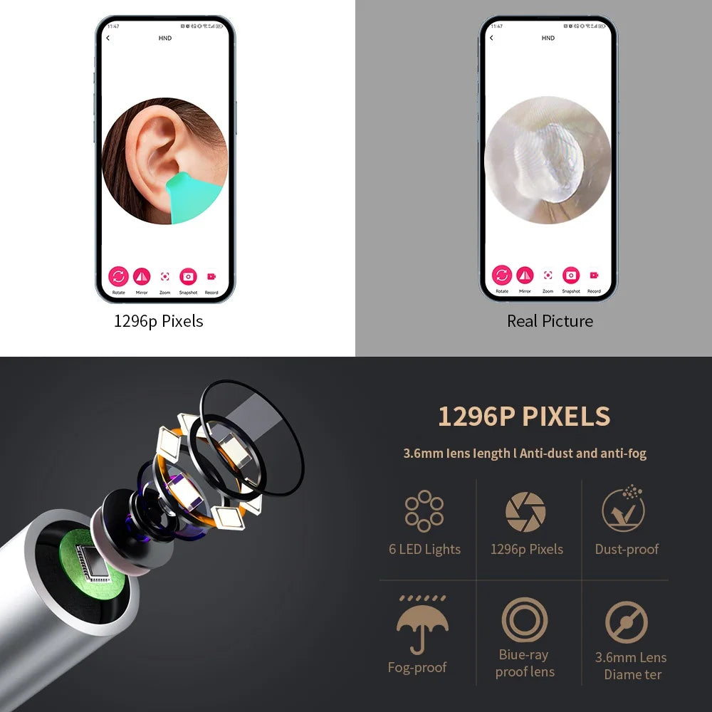 Smart Visual Ear Wax Cleaner